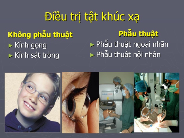 1. Đeo kính gọng