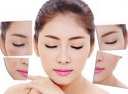 Xóa nám, hết tàn nhang với 2 phương pháp trị nám được yêu thích nhất 1