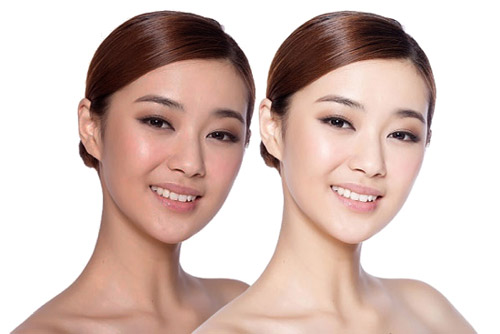 Xóa nám, hết tàn nhang với 2 phương pháp trị nám được yêu thích nhất 3