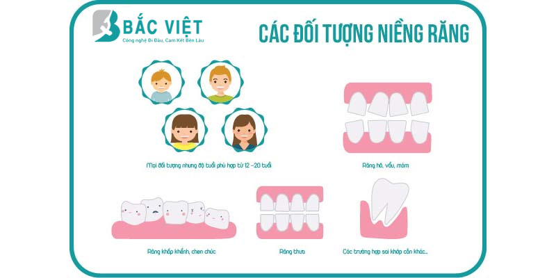 các trường hợp nên niềng răng thẩm mỹ 