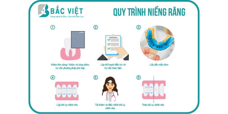 Tháo mắc niềng răng