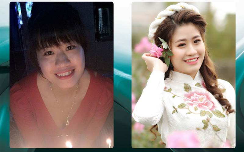 hình ảnh khách hàng niềng răng