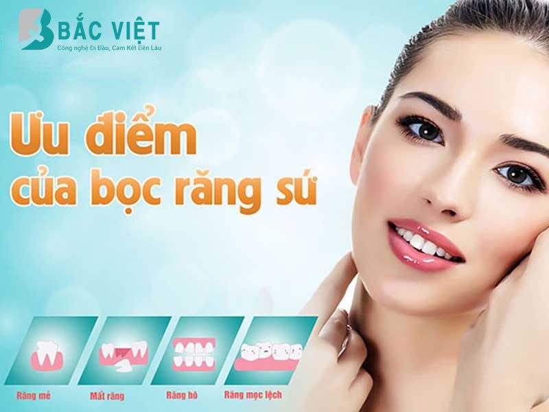 Răng sứ Cercon HT - Ưu điểm cấu tạo