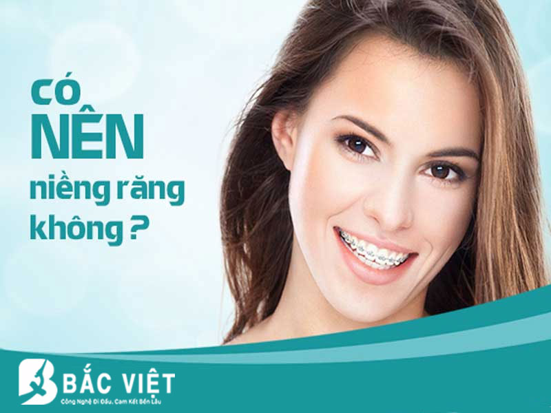 Có nên niềng răng không?