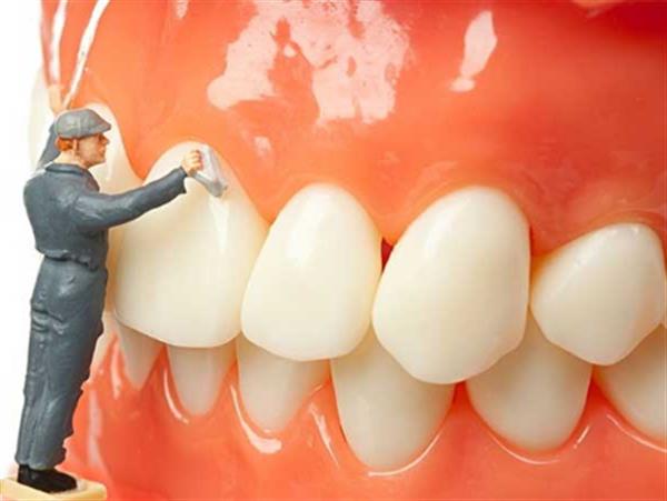 Lấy cao răng siêu âm – sự lựa chọn hàng đầu của các nha sĩ