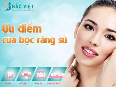 Răng sứ Cercon HT - Ưu điểm cấu tạo