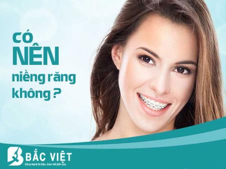 Có nên niềng răng không?